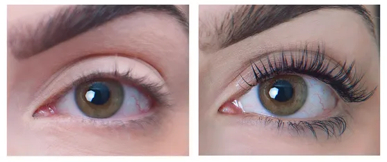 Wimperlift
