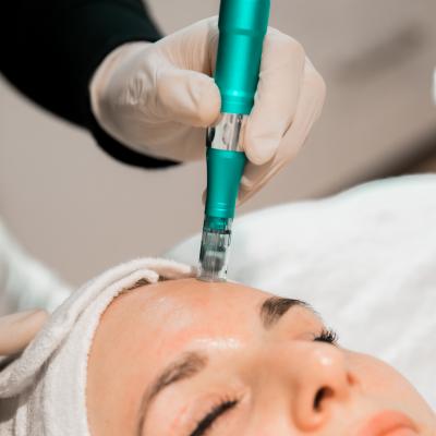 Microneedling Microneedling