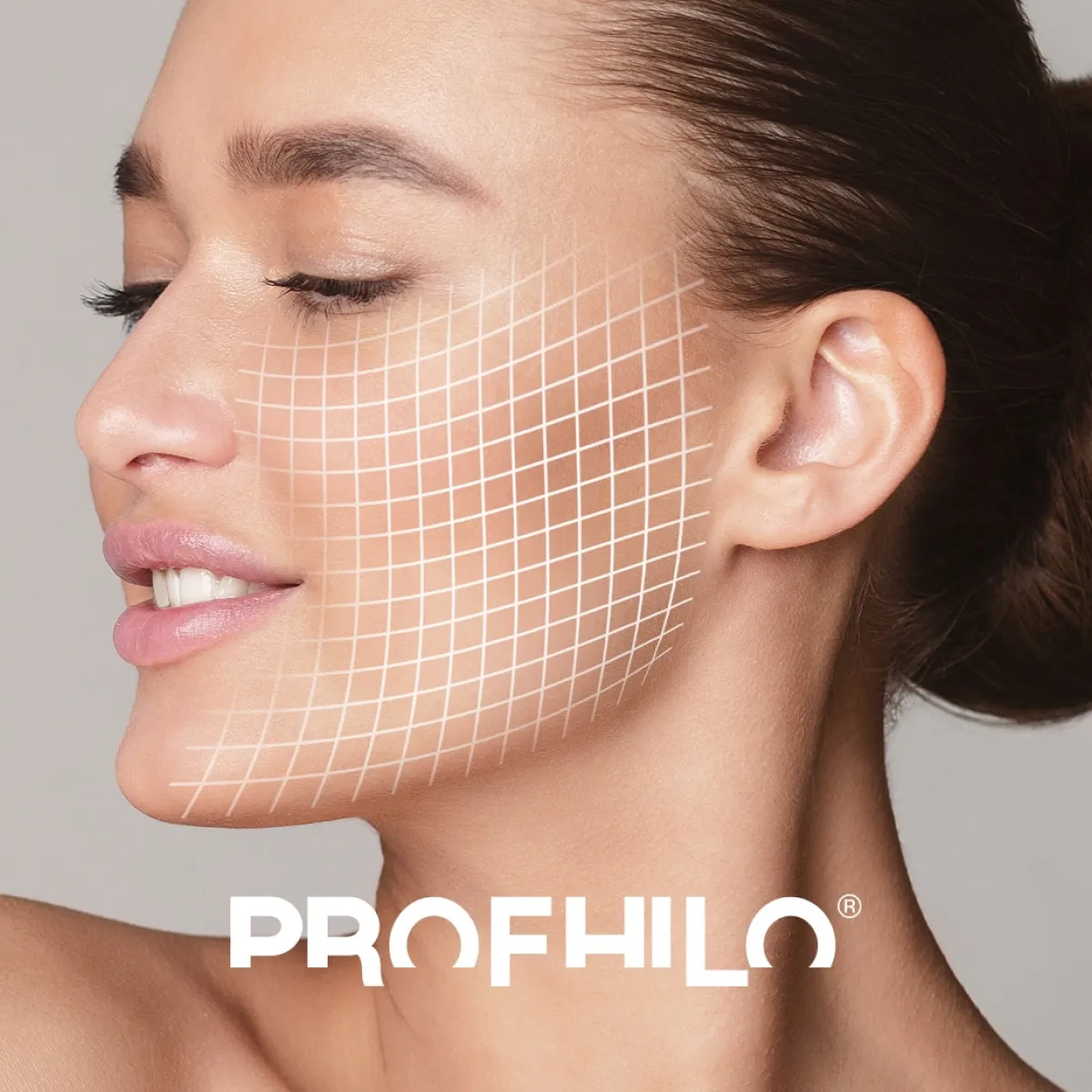 Profhilo
